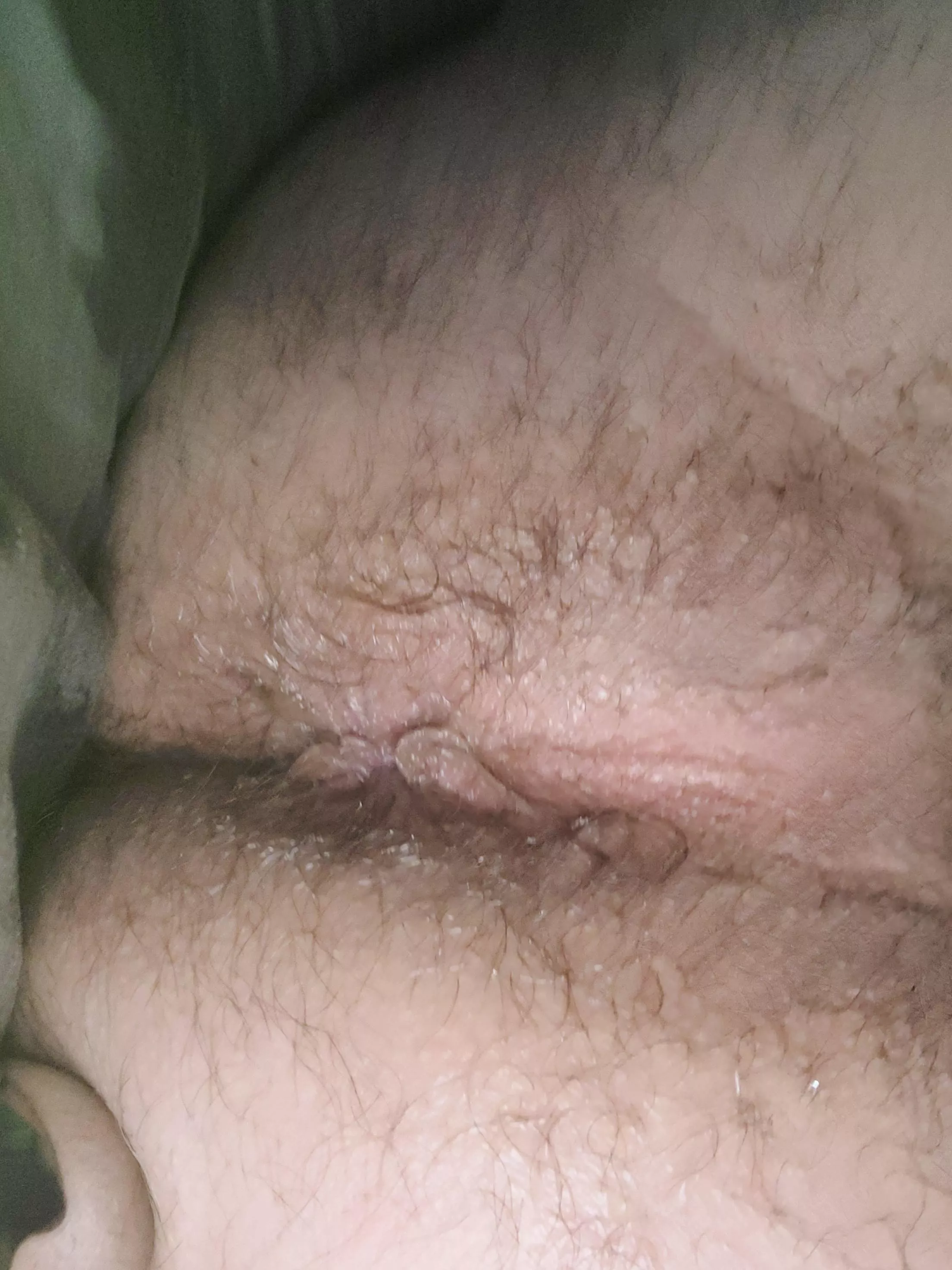 my hairy ass hole