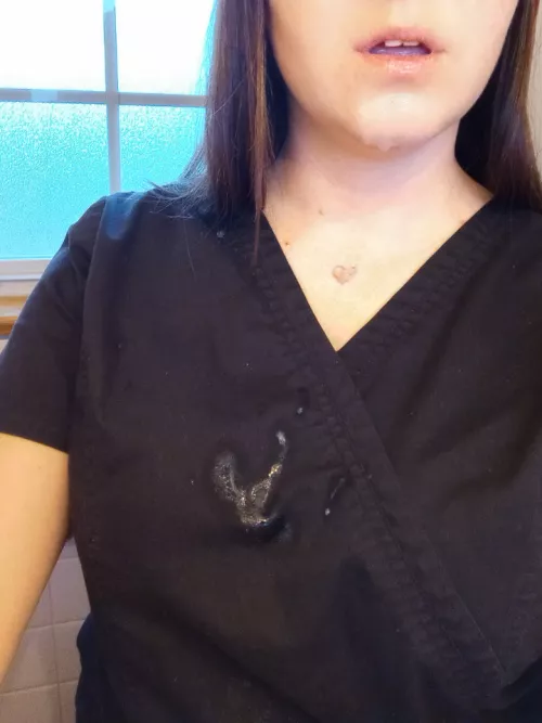 My Patient got a Little Excited to see me