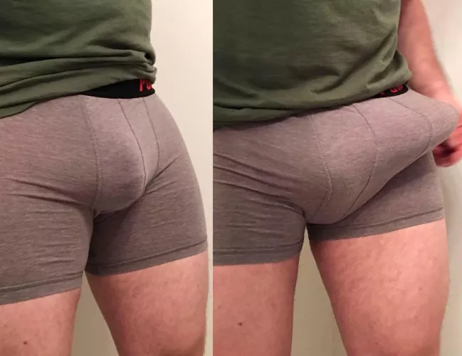 Soft bulge v hard bulge
