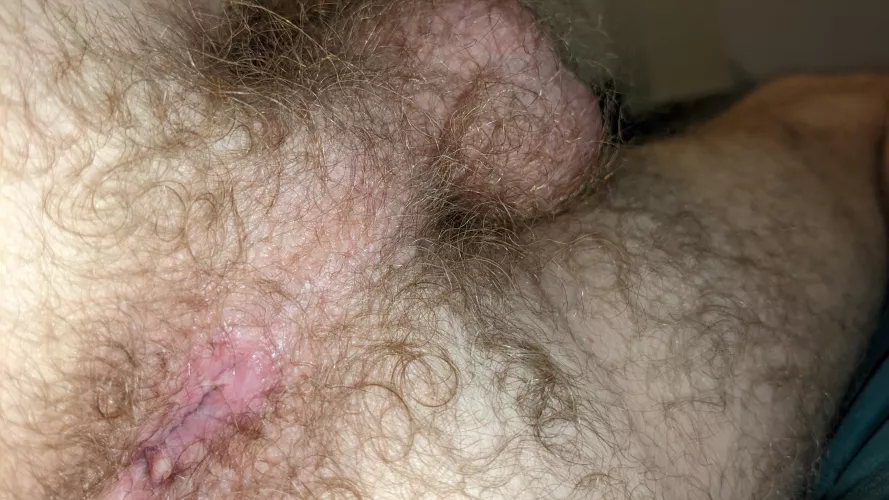 Anyone for some hairy hole (or any of the rest)?