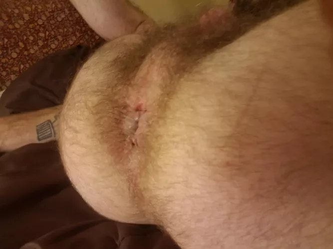 here for your pleasure :) [34]