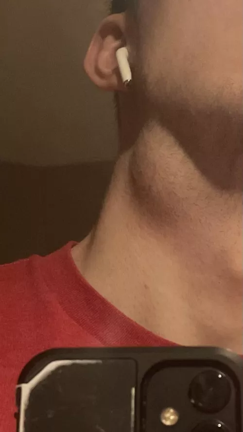 Getting this drained tomorrow morning, should I experience any pain?