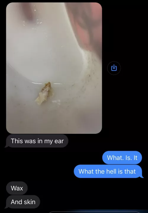 My husband had to get this taken out of his inner ear today