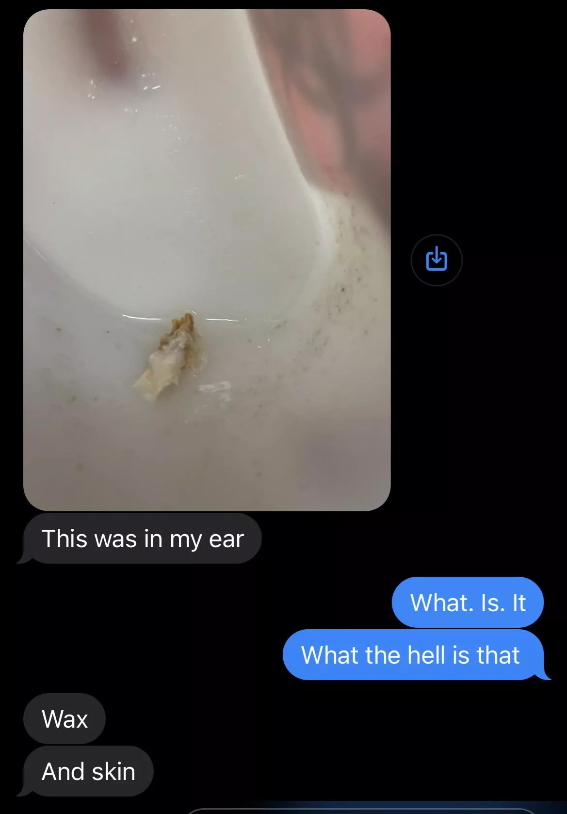 My husband had to get this taken out of his inner ear today