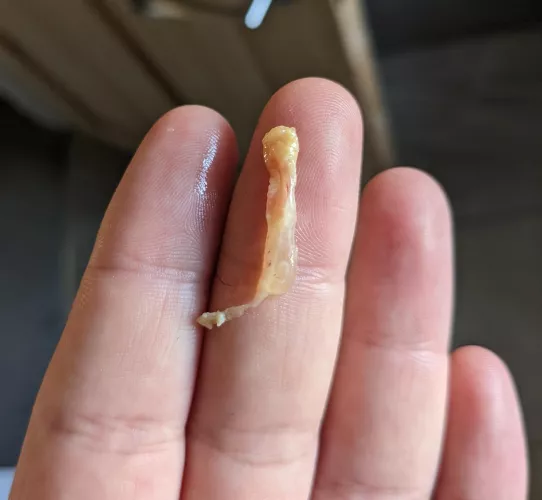 Pulled this out after an ear infection