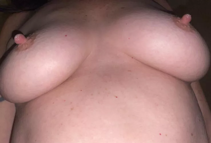 Dry crusty milk on those nips