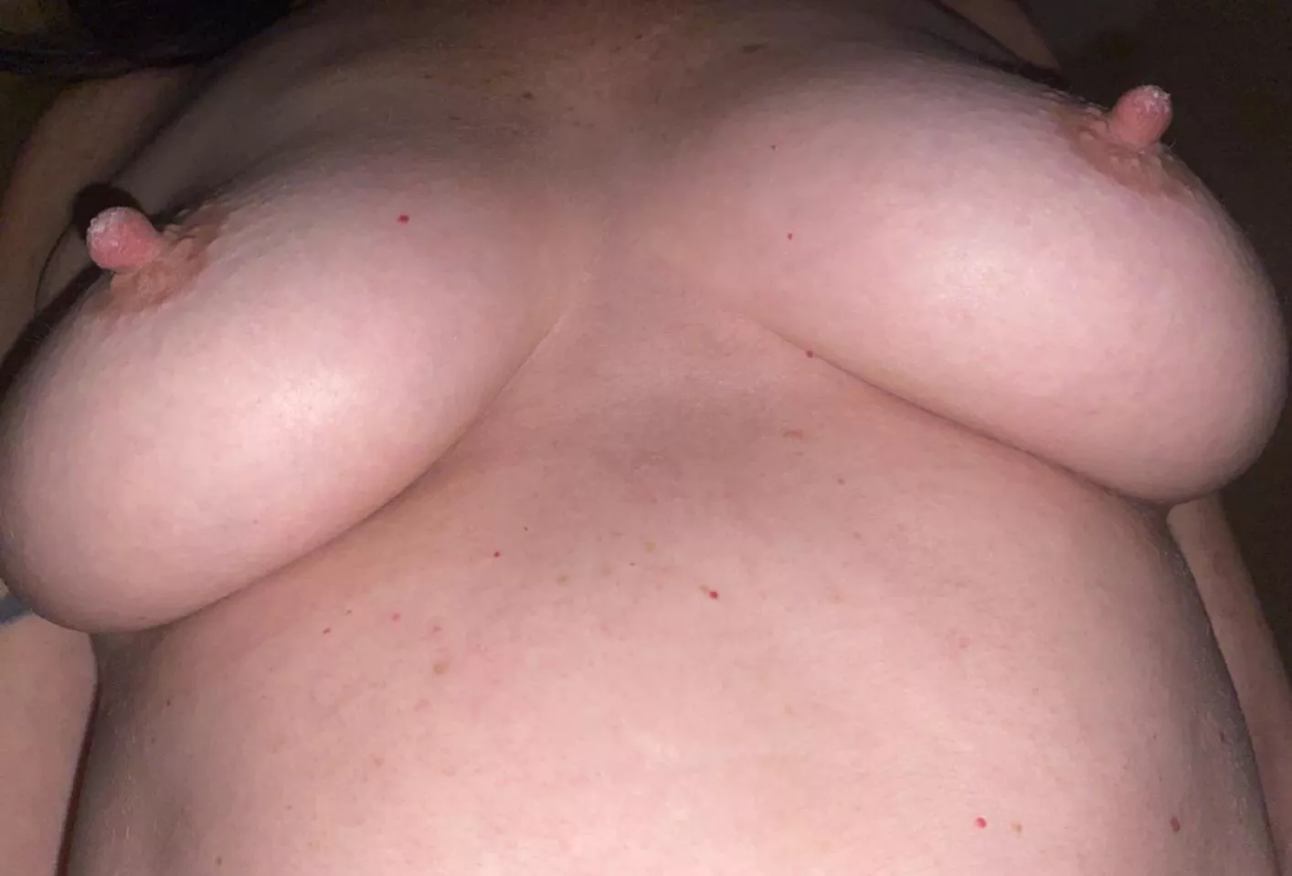 Dry crusty milk on those nips