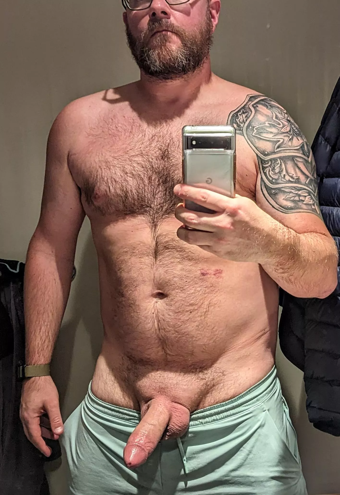 Has been 3 days since the knee surgery. Definitely in a mood [38]