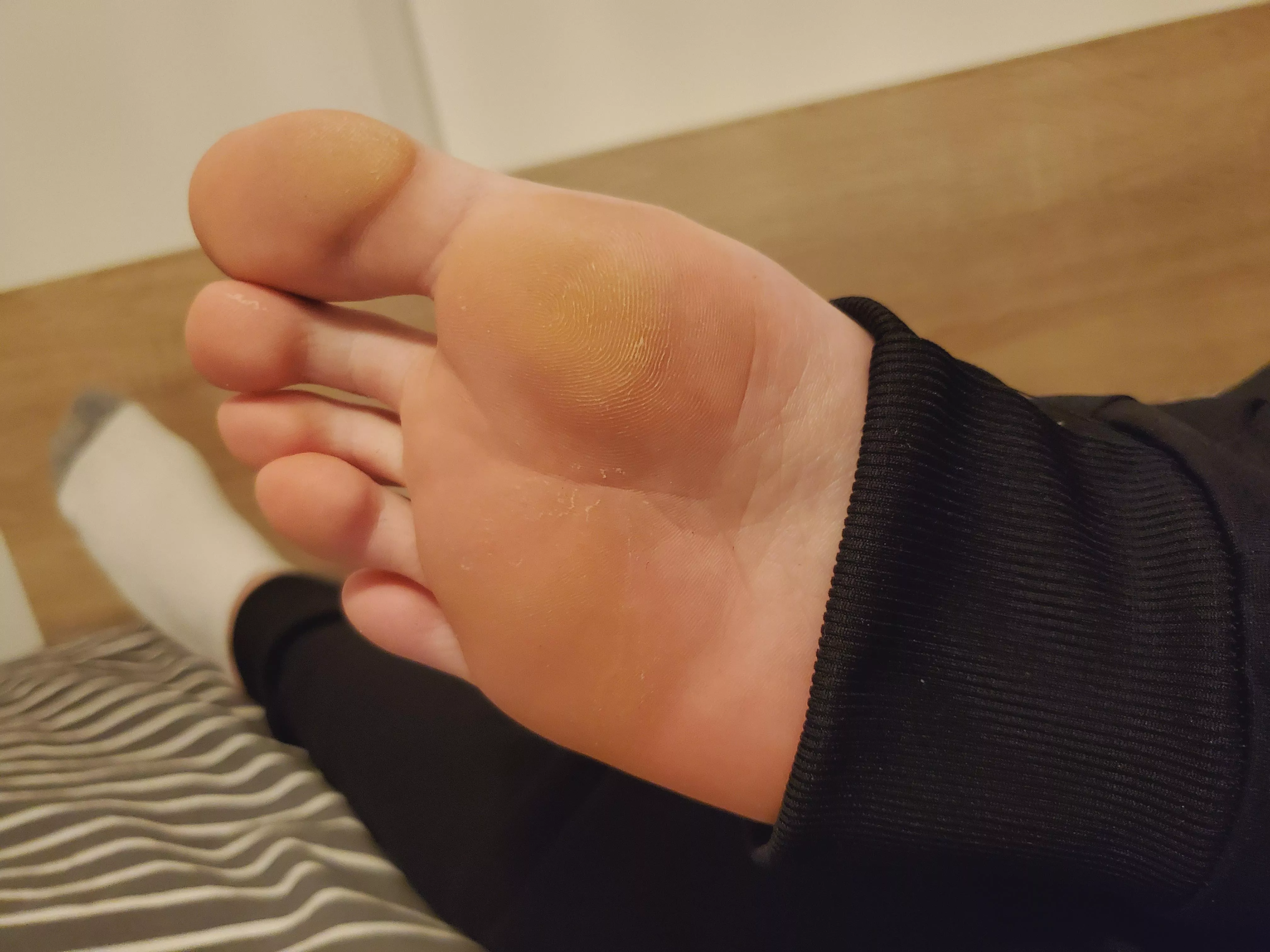 I've lost my sock, gotta find a way to warm up that foot 😅