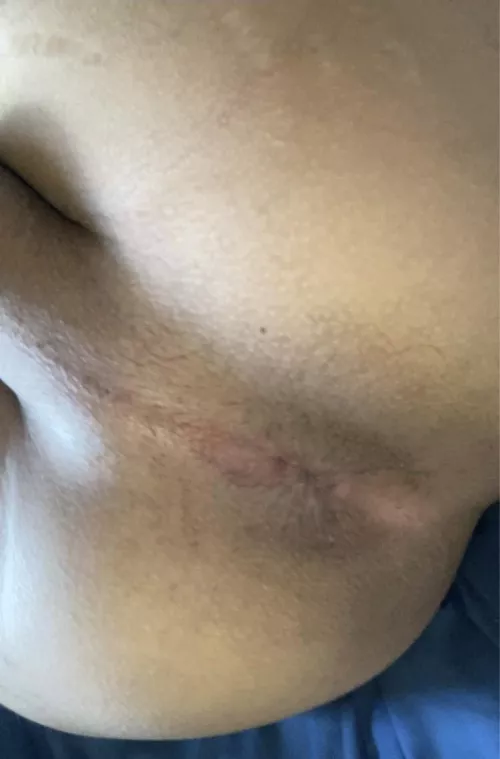 My boy pussy needs some work done 😜