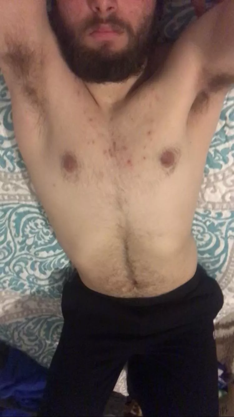 Pits on full display.