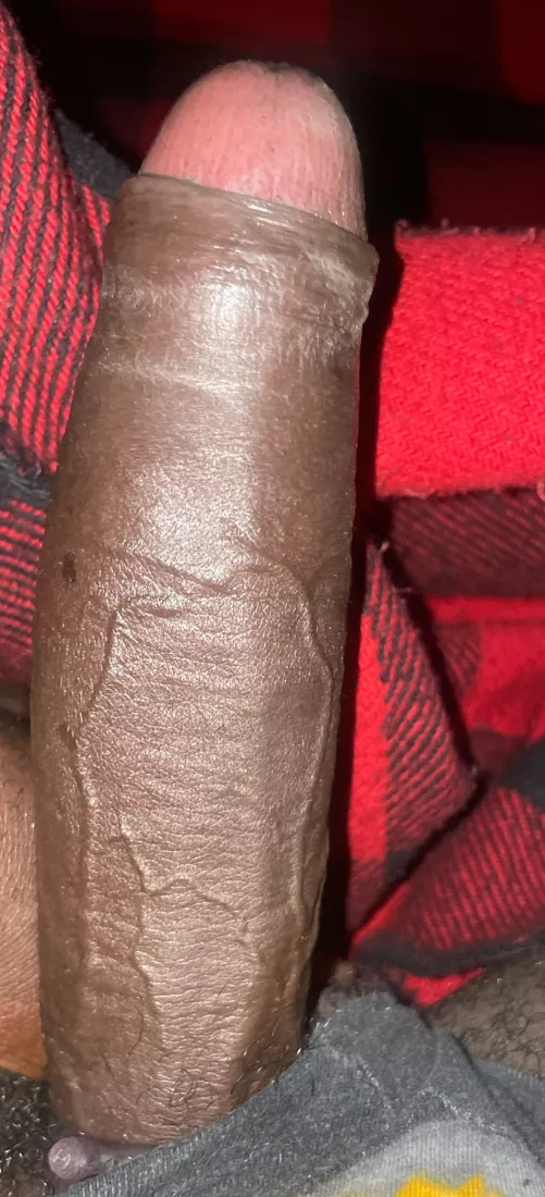 Veins anyone