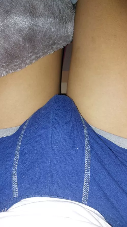 i want u to remove it