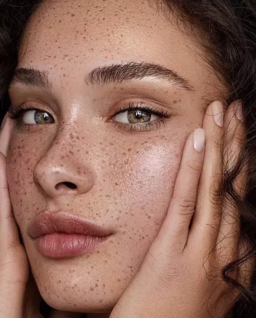 Soft freckles