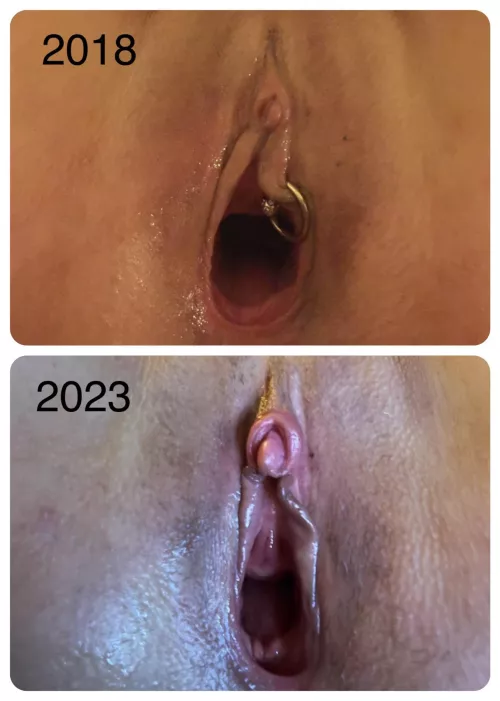 Clit Growth (DHT)