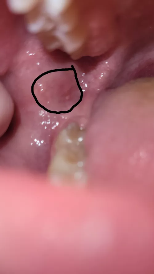 does anyone have a clue of what this is?? also the right side of my jaw has been hurting didn't lock up or scream or nothing sorry for alot of questions I get very concerned about this stuff