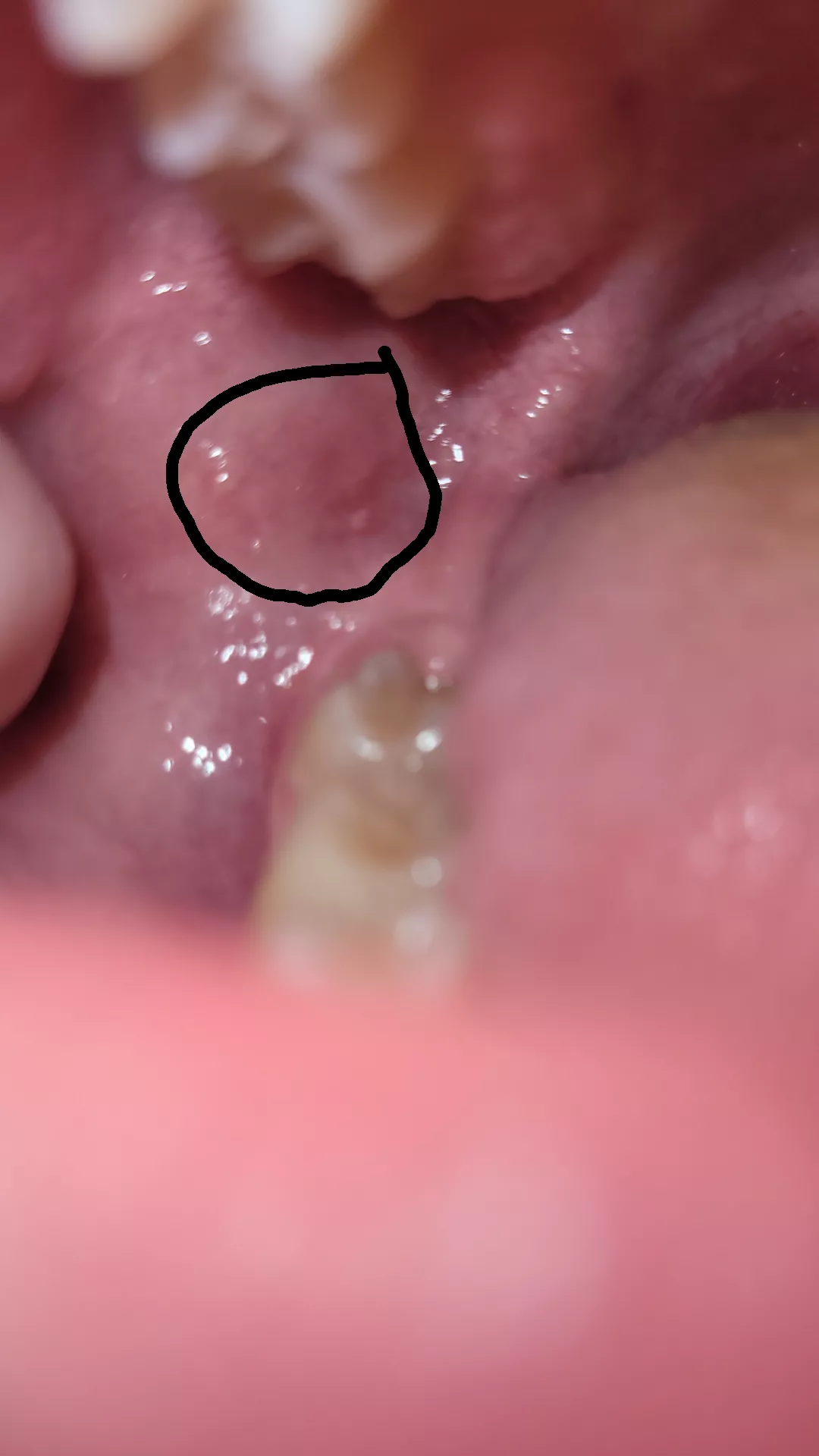 does anyone have a clue of what this is?? also the right side of my jaw has been hurting didn't lock up or scream or nothing sorry for alot of questions I get very concerned about this stuff
