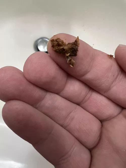 I can hear again! Thought I had hearing damage until I pulled this bad boy out.