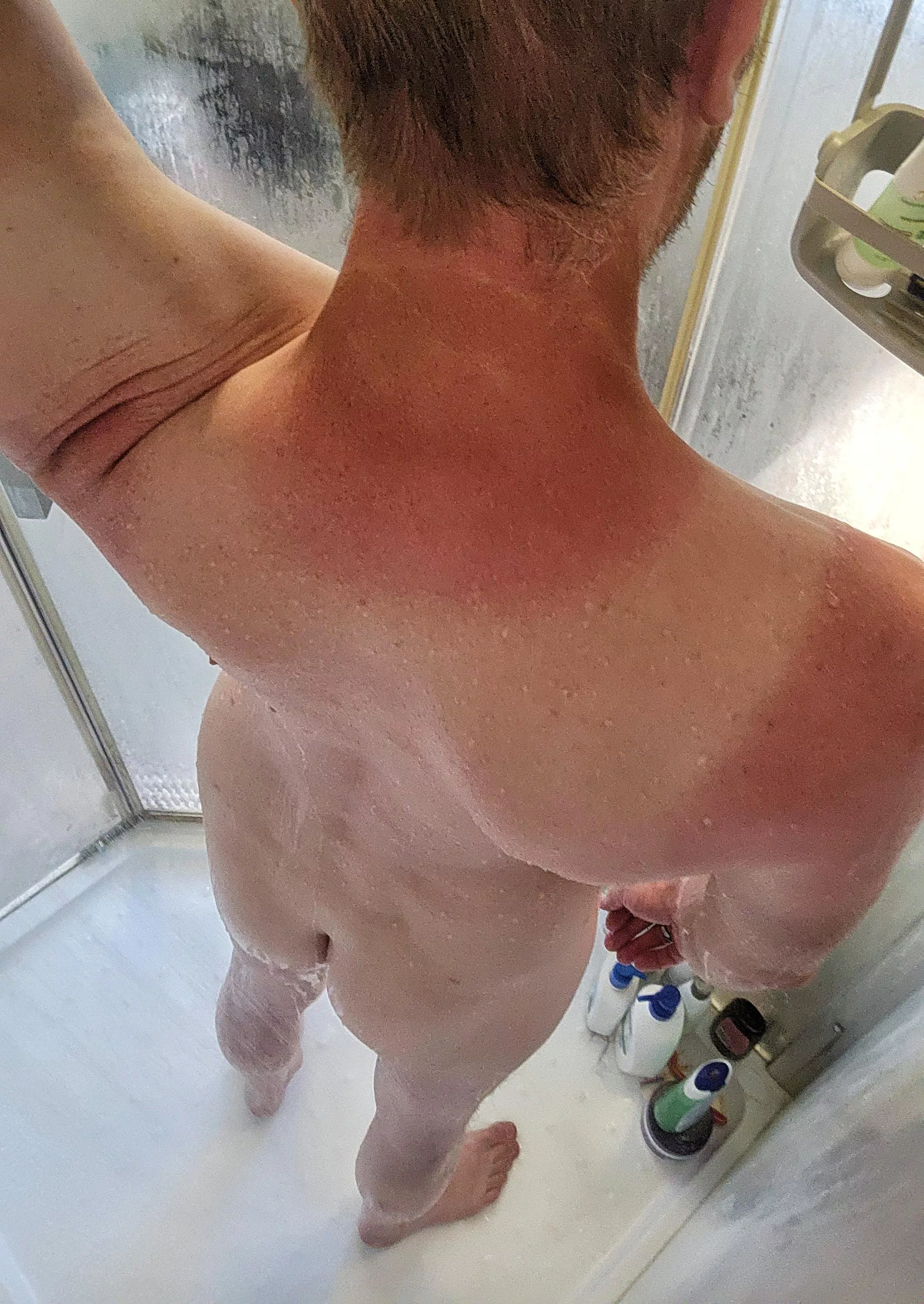 I concede I deserve a spanking for forgetting my sunscreen