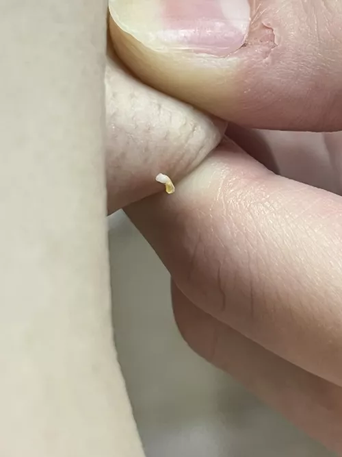 I wish I could have recorded it but this thing I popped that’s been driving me nuts for the last 2 weeks or so in my armpit that I couldn’t reach but I finally got it this morning🙌🏻🙌🏻🙌🏻🙌🏻