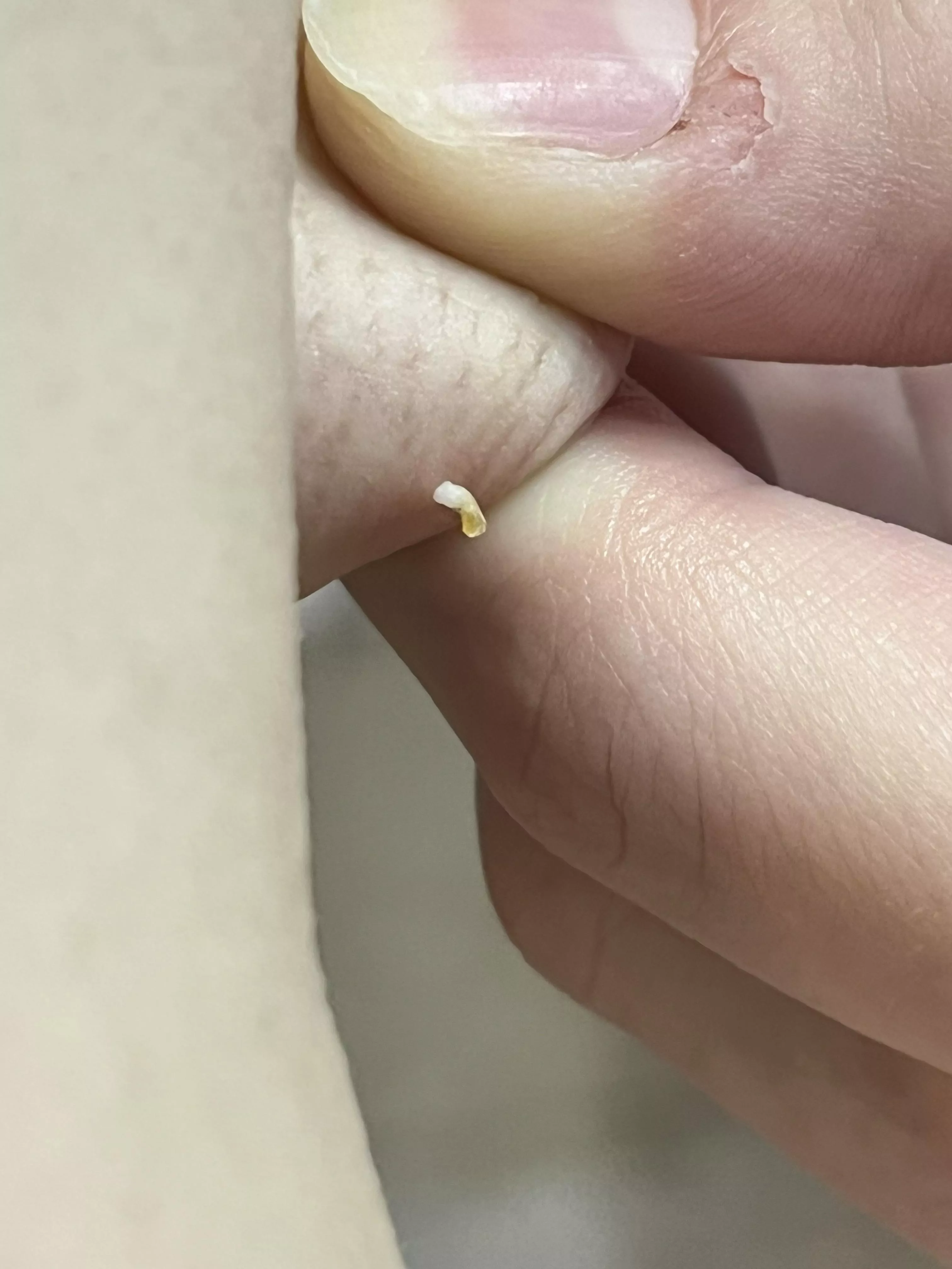 I wish I could have recorded it but this thing I popped that’s been driving me nuts for the last 2 weeks or so in my armpit that I couldn’t reach but I finally got it this morning🙌🏻🙌🏻🙌🏻🙌🏻