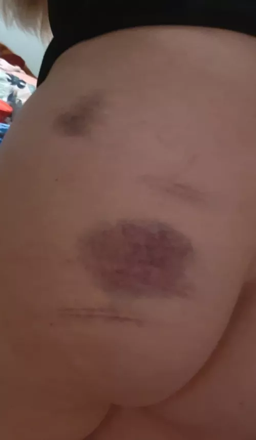 Leftovers from the cane; enough is never enough