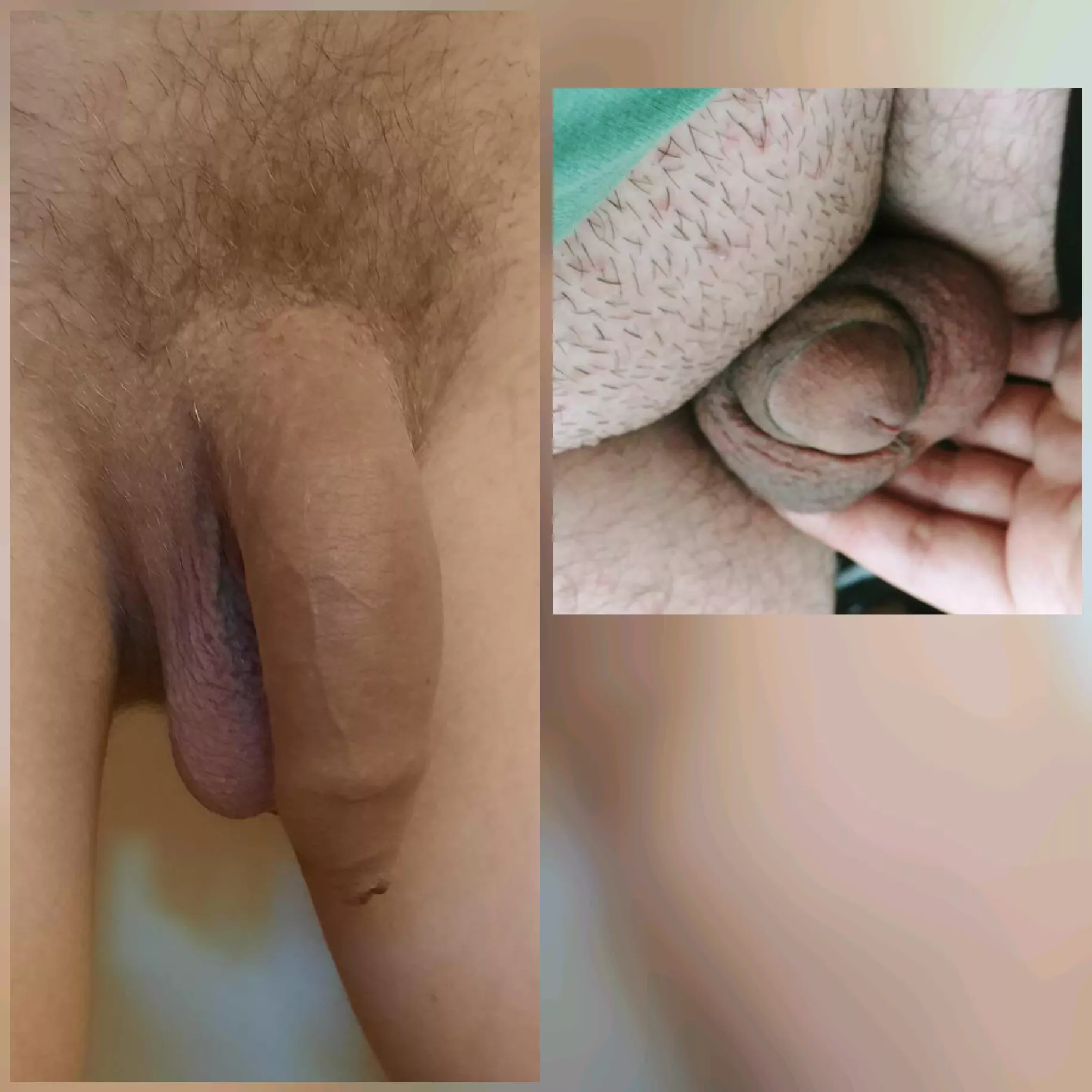 Me(left) vs. Another redditor compared soft 😁 His tiny dick is just the head, where's the shaft? 🤣
