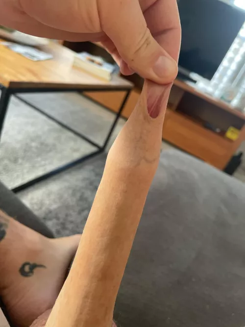 My hood is so thick, is this normal?