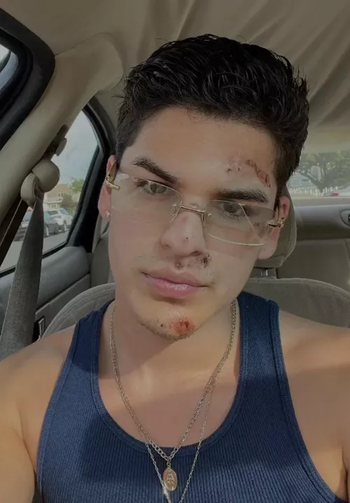 ran over by a car two nights ago but I think the face card never declines