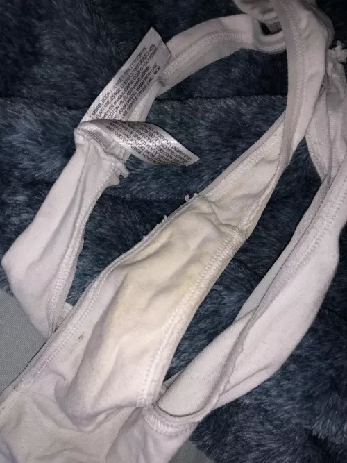 I’ve only had these a week and they’re already discoloring😌😭