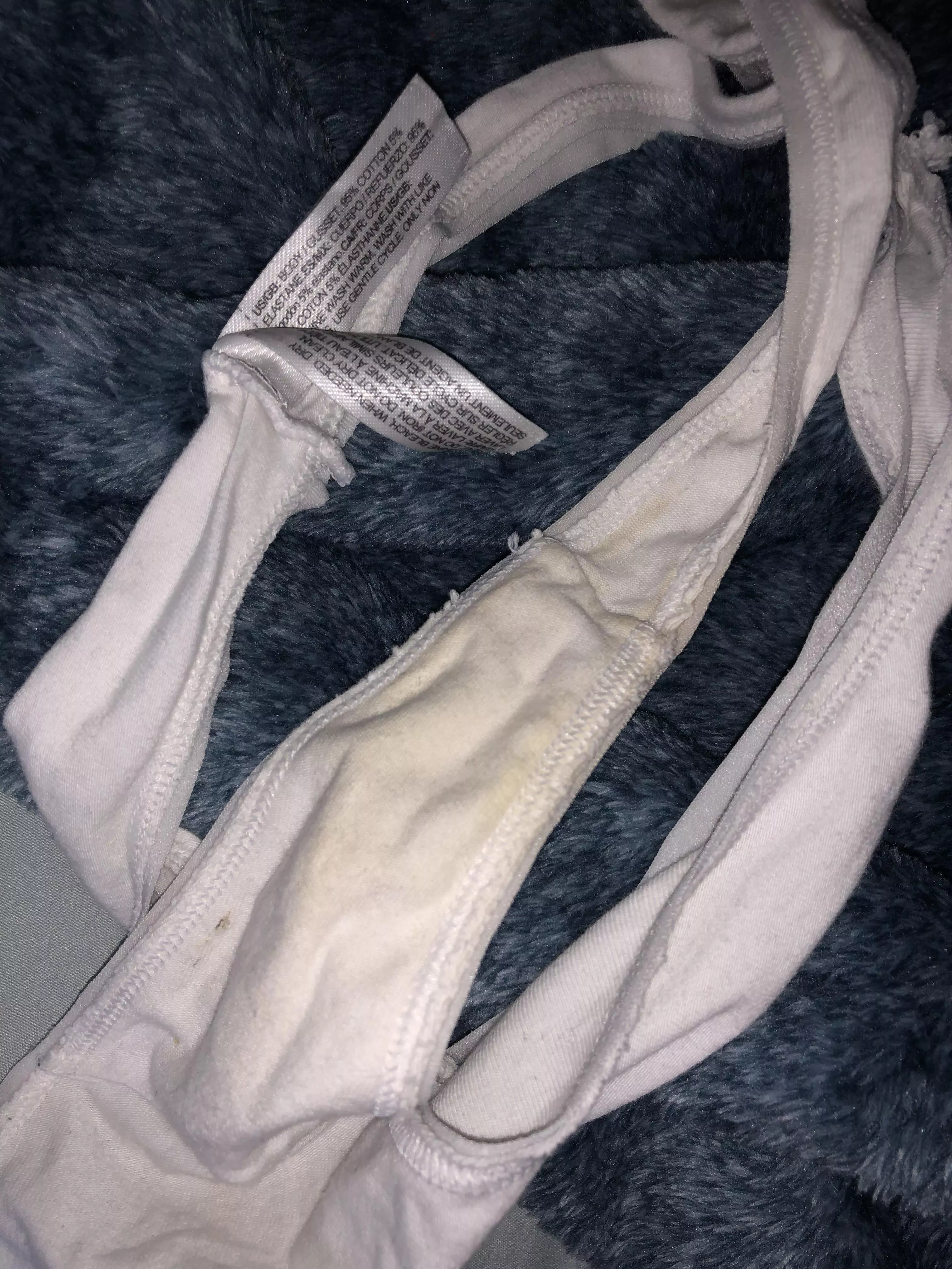 I’ve only had these a week and they’re already discoloring😌😭