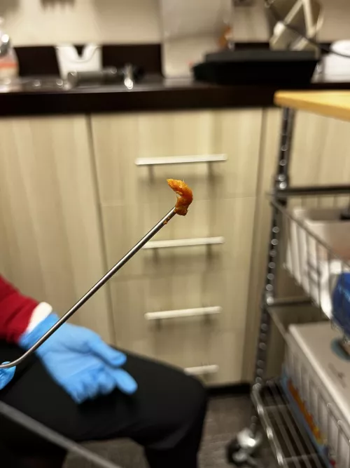 Just Before Xmas I Went to a Hearing Clinic Because My Left Ear Didn’t Feel Proper. The Audiologist Used a Suction Machine. It’s Been Three Weeks and My Hearing is So. Much. Better.