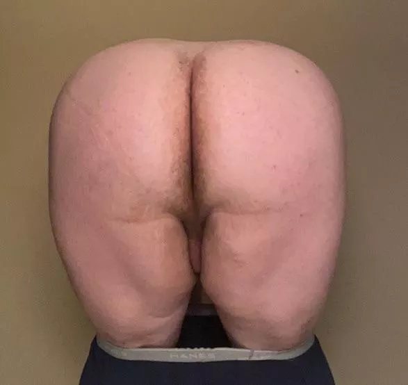 My massive ass