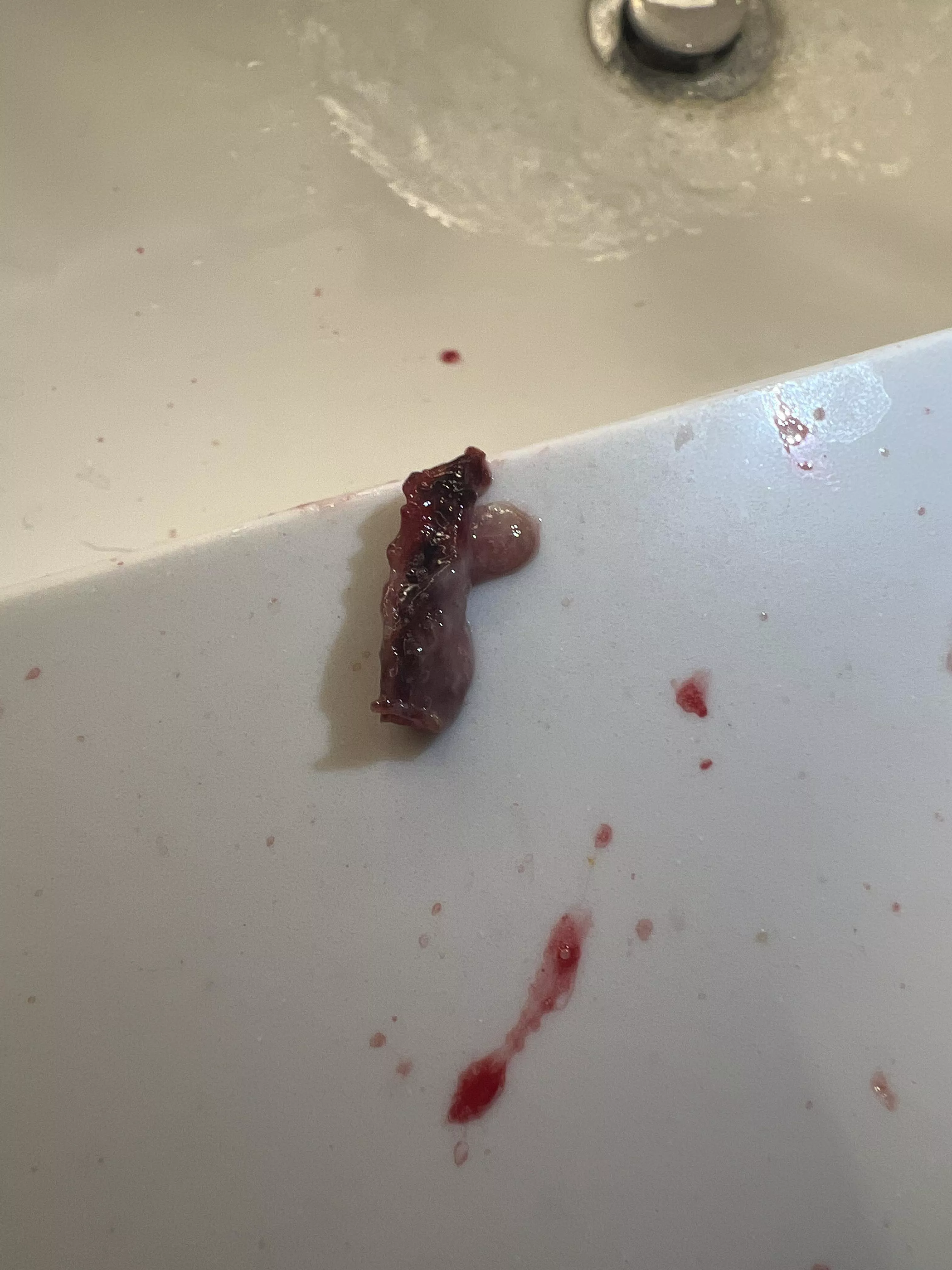 Out of nose, anybody know what this is? I’ve had a sinus infection and don’t know what the hell this is when I sneezed and caused my nose to bleed. Any insight and remedy’s for this would be great (currently on antibiotics)