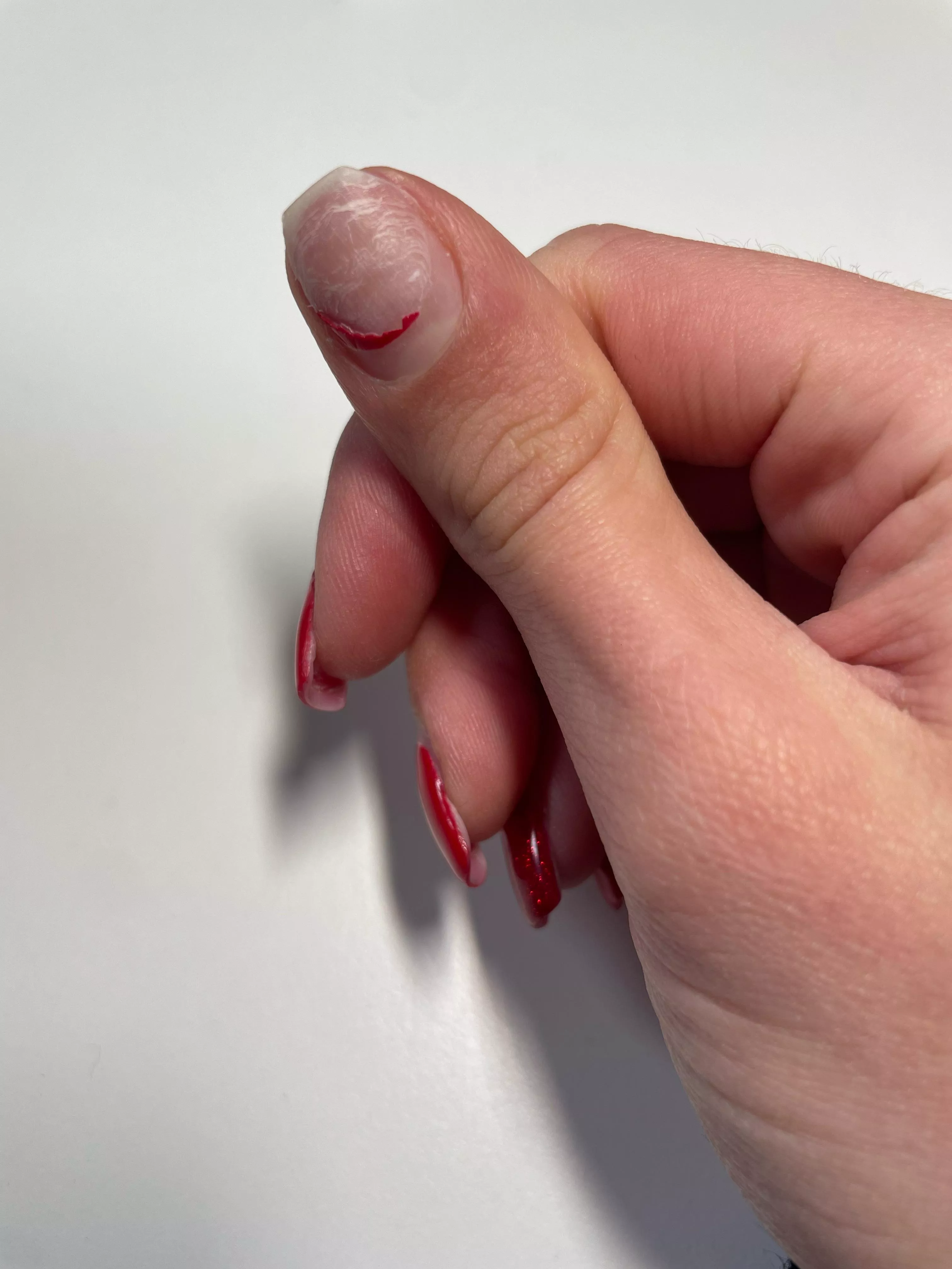 Who wants to give me support?