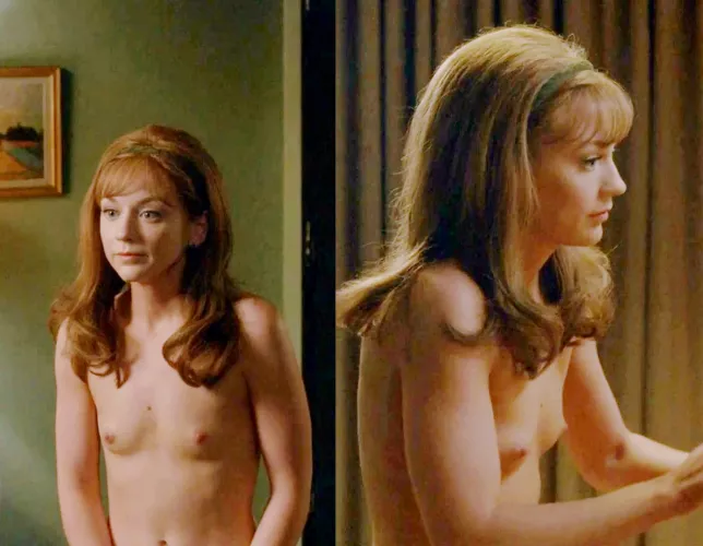 Emily Kinney showing her mosquito bites