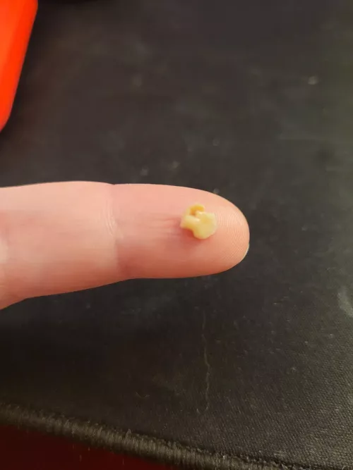 i sneezed and this bad boy came up! i never got a tonsil stone before, so this was super exciting!