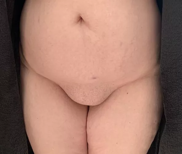 Love my wife’s belly and fupa.