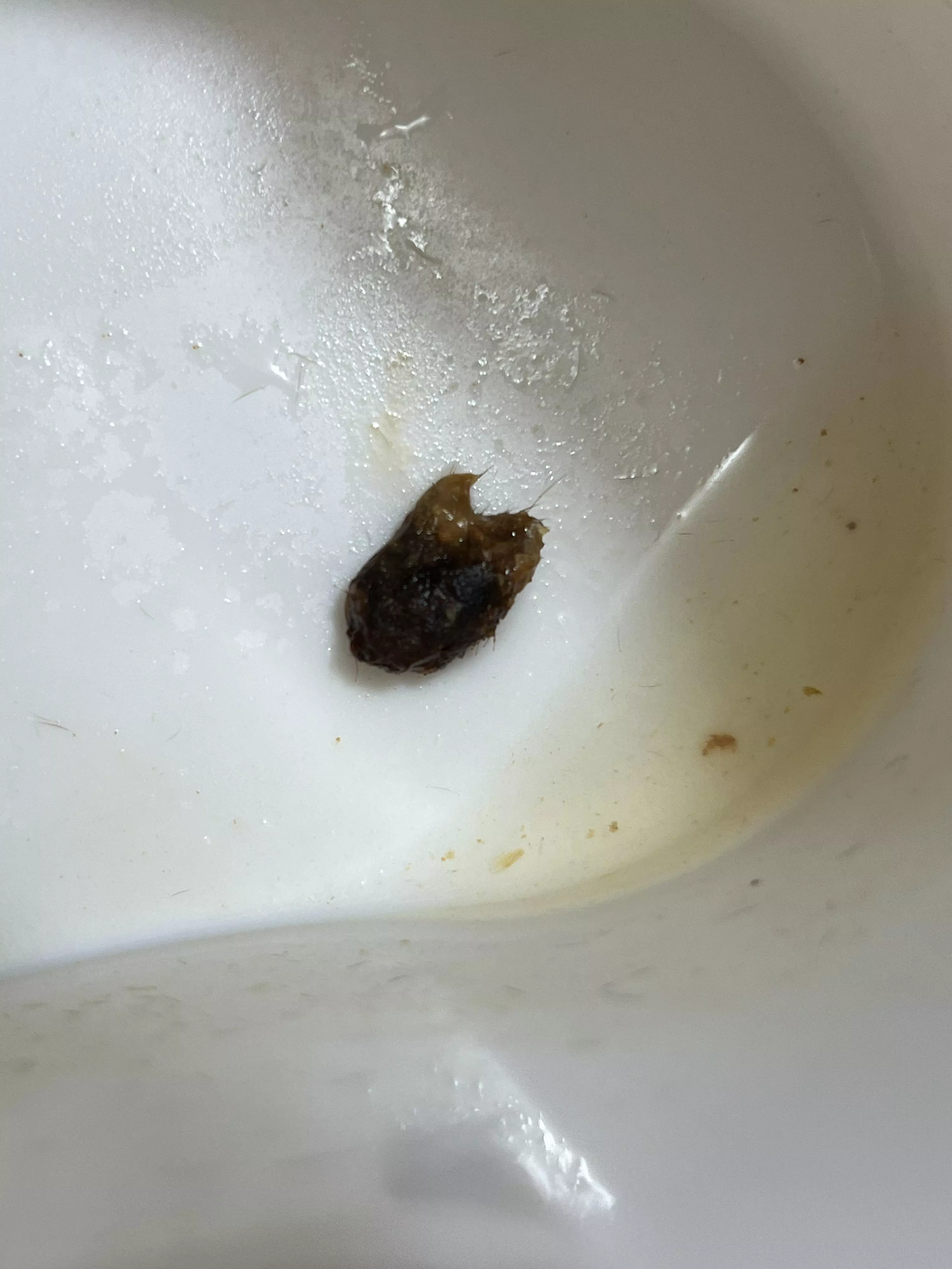 Chunk of impacted earwax I irrigated out of my ear!