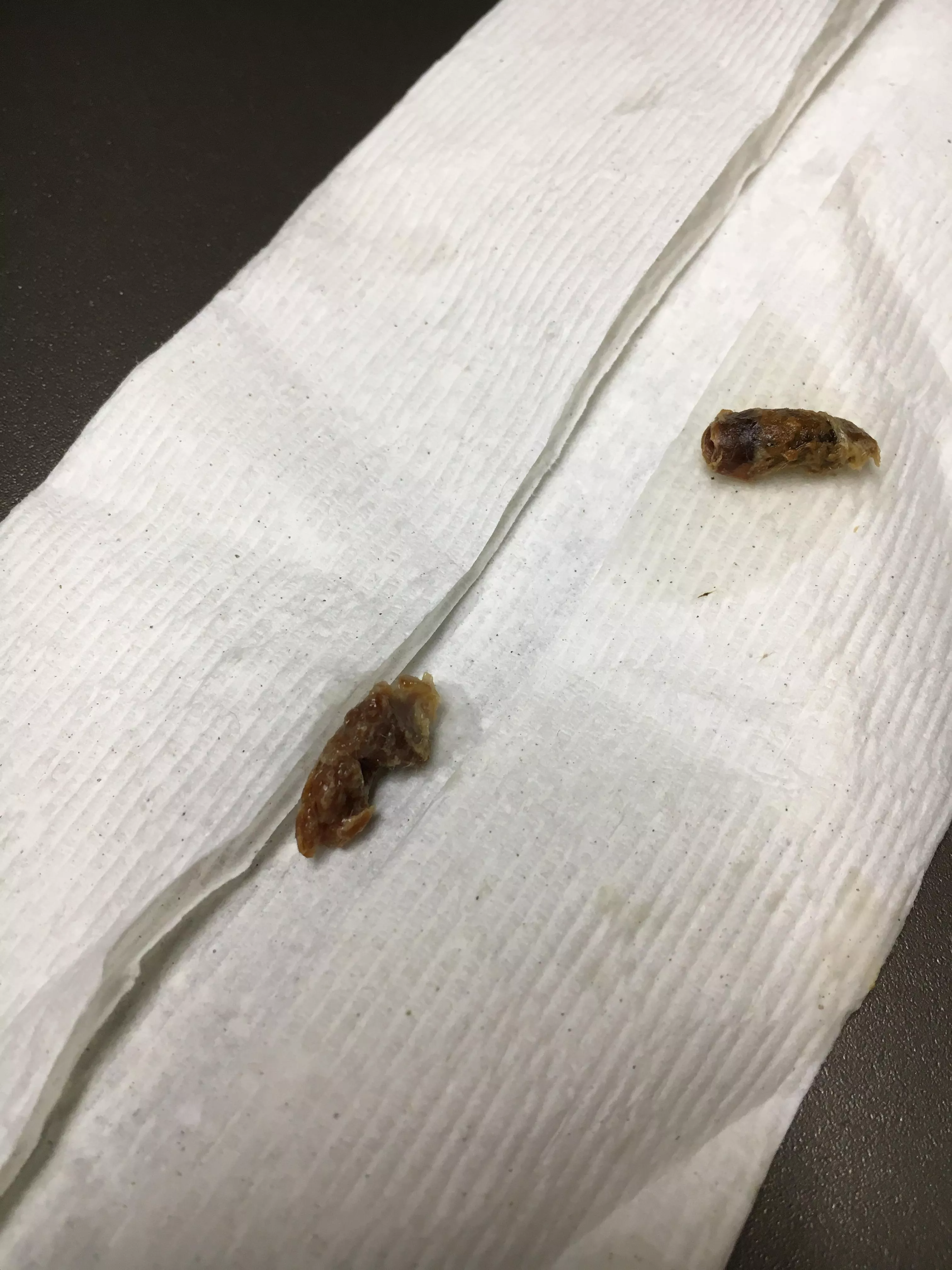 Doctor said some people just produce more earwax than others