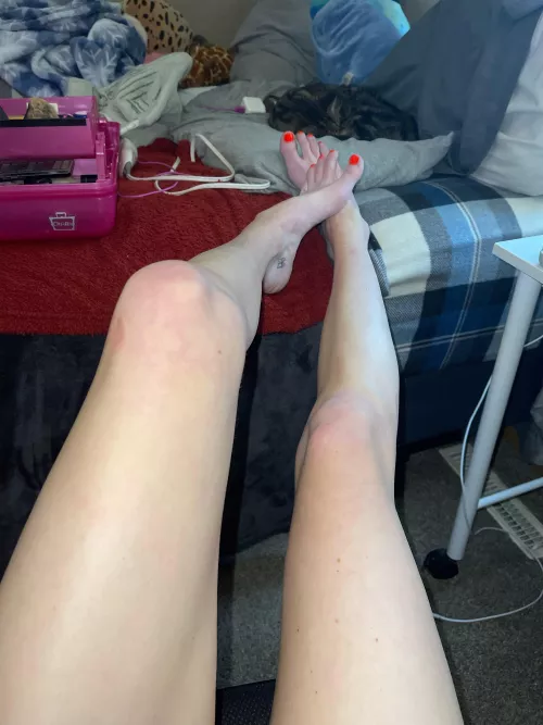 long legs , neon toes , and it’s humpday !! it couldn’t get better 🥰✨