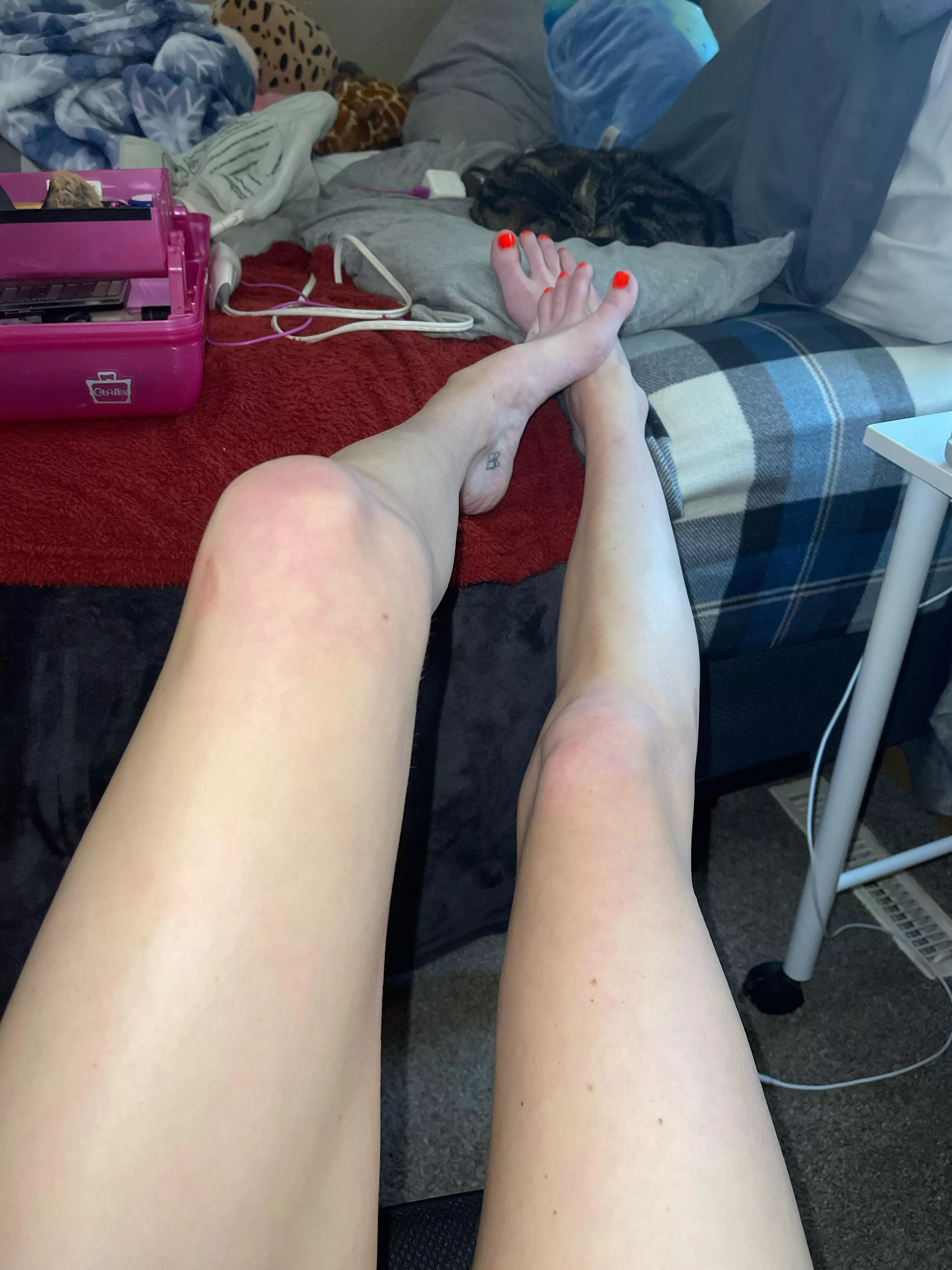 long legs , neon toes , and it’s humpday !! it couldn’t get better 🥰✨