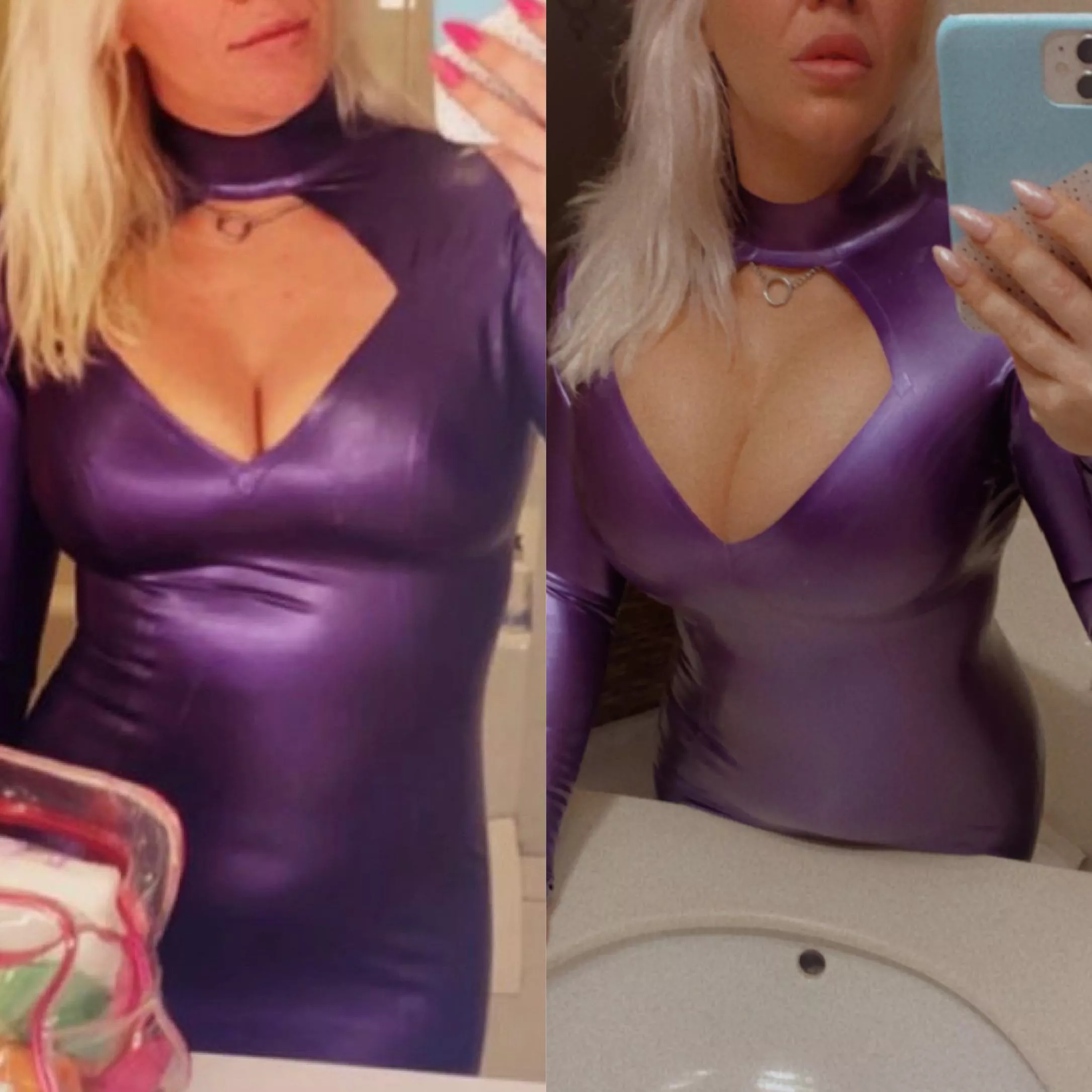 New expanders put in, from natural 32E to 800cc saline, 32j next fill up in Feb! Guess my size then!