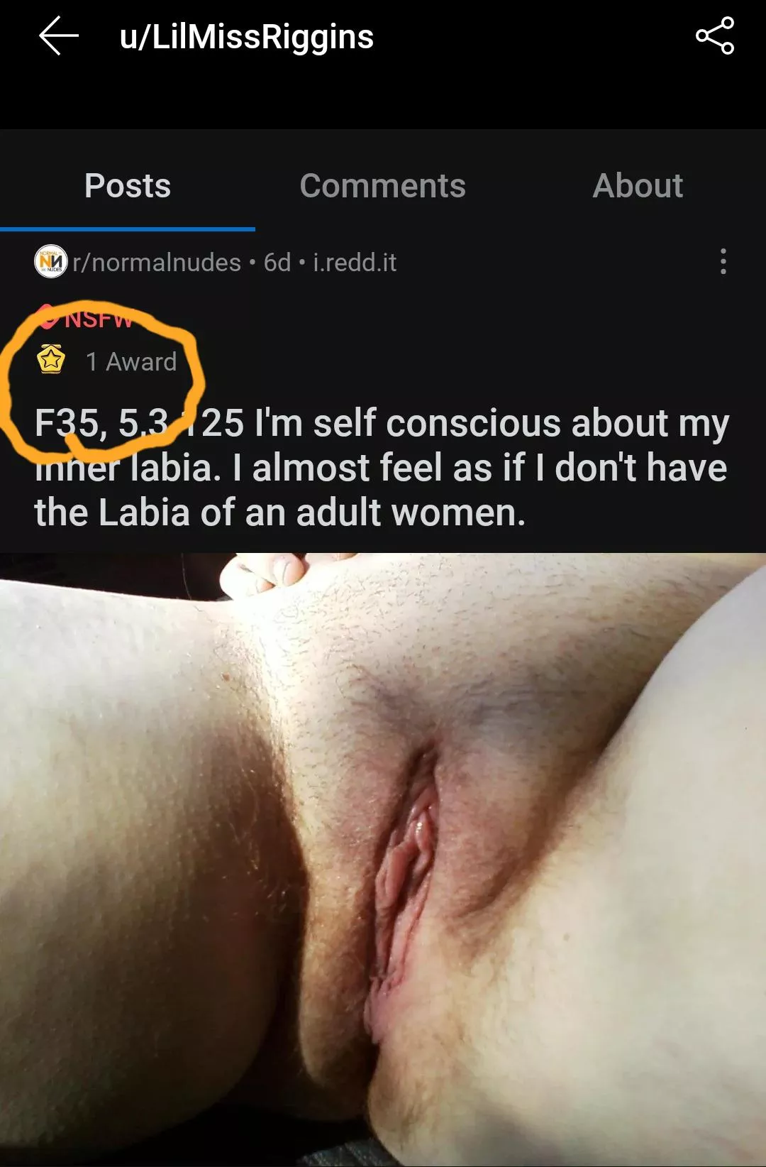 Thank you to everyone I literally have a award winning Labia. lol thank you all for 1the confidence boost.