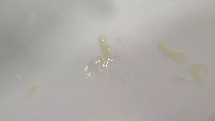 Does it happen to anyone else that when you go a long time without cumming, your cum turns yellowish? 🤔