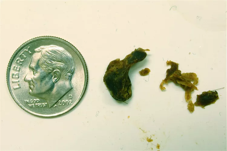 Ear was completely plugged that I started to lose balance. Flushed this out with the drops and the world sounds crunchy clear