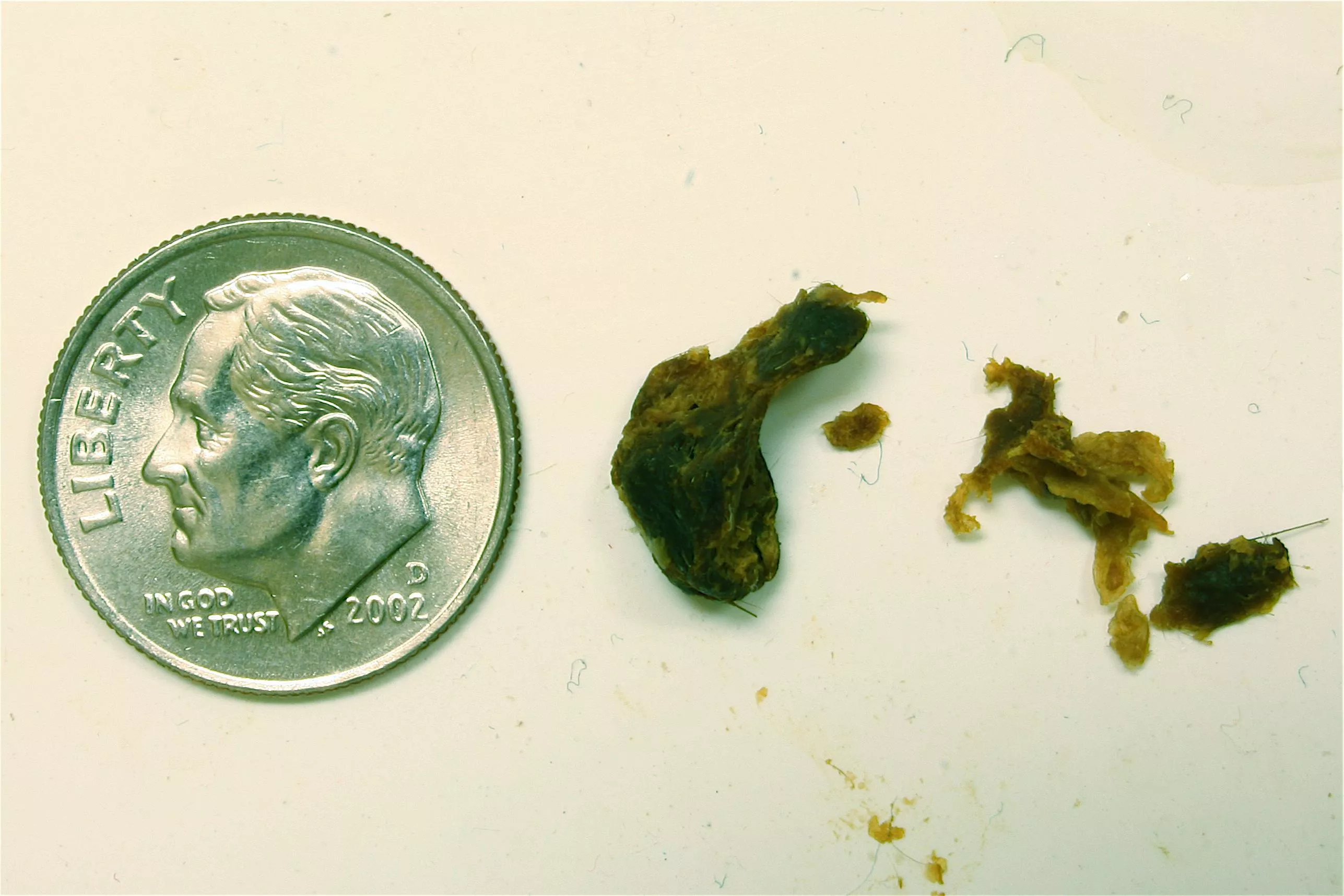 Ear was completely plugged that I started to lose balance. Flushed this out with the drops and the world sounds crunchy clear