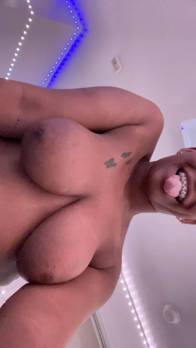 I hope my braces are cute! If you even noticed lol