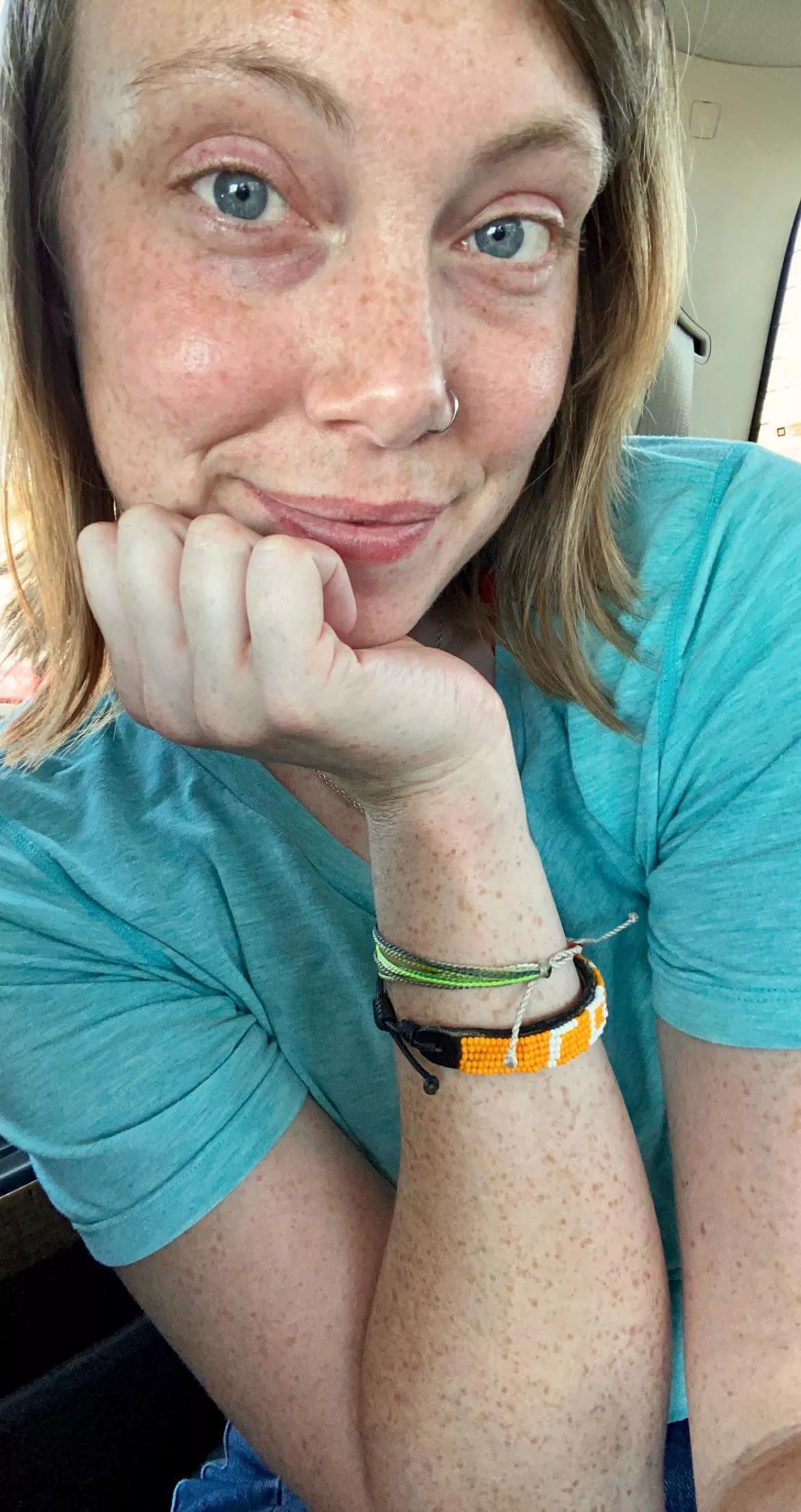 I remember being a little girl and begging and crying to my mom to have a doctor remove my freckles. Now that I’m older I realize just how lucky I am to have them.