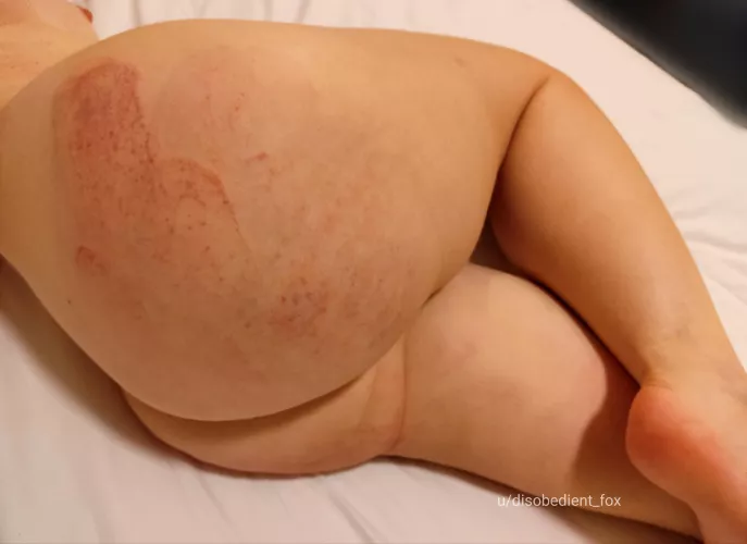 I wonder what this will look like tomorrow [F]